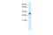 Zinc Finger Protein 654 antibody, A17664, Boster Biological Technology, Western Blot image 