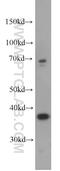 Galactose Mutarotase antibody, 16022-1-AP, Proteintech Group, Western Blot image 