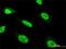 Zinc Finger Protein 71 antibody, H00058491-M01, Novus Biologicals, Immunocytochemistry image 