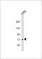 DDB1 And CUL4 Associated Factor 8 Like 2 antibody, 56-104, ProSci, Western Blot image 