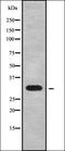 Mediator Complex Subunit 4 antibody, orb338415, Biorbyt, Western Blot image 