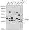 Catechol-O-Methyltransferase antibody, GTX33108, GeneTex, Western Blot image 