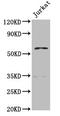 Propionyl-CoA Carboxylase Subunit Beta antibody, CSB-PA017523LA01HU, Cusabio, Western Blot image 