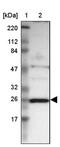 NADH:Ubiquinone Oxidoreductase Core Subunit V2 antibody, PA5-51925, Invitrogen Antibodies, Western Blot image 