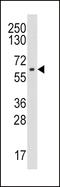 Cytochrome P450 Family 19 Subfamily A Member 1 antibody, LS-C100875, Lifespan Biosciences, Western Blot image 