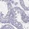 Testis Specific Serine Kinase 4 antibody, NBP2-62713, Novus Biologicals, Immunohistochemistry paraffin image 