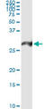 Proteasome Subunit Alpha 7 antibody, LS-B9946, Lifespan Biosciences, Immunoprecipitation image 