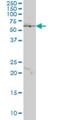 JRK Like antibody, H00008690-M01, Novus Biologicals, Western Blot image 