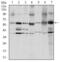 SRC Proto-Oncogene, Non-Receptor Tyrosine Kinase antibody, GTX60521, GeneTex, Western Blot image 