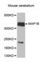 Microtubule Associated Protein 1B antibody, abx002352, Abbexa, Western Blot image 