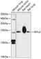 Myosin Light Chain 4 antibody, 14-871, ProSci, Western Blot image 