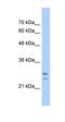 SRP Receptor Subunit Beta antibody, orb330595, Biorbyt, Western Blot image 