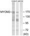 Myomesin 2 antibody, TA314871, Origene, Western Blot image 