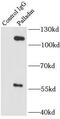 Palladin, Cytoskeletal Associated Protein antibody, FNab06127, FineTest, Immunoprecipitation image 