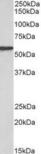 Colony Stimulating Factor 3 Receptor antibody, 43-704, ProSci, Enzyme Linked Immunosorbent Assay image 