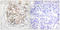 Protein Kinase, DNA-Activated, Catalytic Subunit antibody, LS-C198886, Lifespan Biosciences, Immunohistochemistry paraffin image 