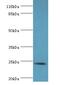 Syntaxin Binding Protein 6 antibody, LS-C371888, Lifespan Biosciences, Western Blot image 