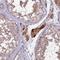 Component Of Oligomeric Golgi Complex 8 antibody, HPA041406, Atlas Antibodies, Immunohistochemistry paraffin image 