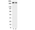 TSC Complex Subunit 2 antibody, R31296, NSJ Bioreagents, Western Blot image 