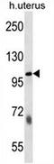 Sulfatase 2 antibody, AP54099PU-N, Origene, Western Blot image 