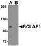 BCL2 Associated Transcription Factor 1 antibody, A04100-1, Boster Biological Technology, Western Blot image 