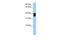 Solute Carrier Family 25 Member 31 antibody, PA5-44133, Invitrogen Antibodies, Western Blot image 