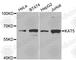 Lysine Acetyltransferase 5 antibody, A2292, ABclonal Technology, Western Blot image 