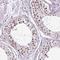Structural Maintenance Of Chromosomes 5 antibody, NBP2-47271, Novus Biologicals, Immunohistochemistry paraffin image 