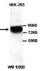 TLE Family Member 4, Transcriptional Corepressor antibody, orb77381, Biorbyt, Western Blot image 