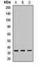 Syndecan 1 antibody, orb411970, Biorbyt, Western Blot image 