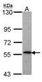 Matrix Metallopeptidase 28 antibody, PA5-28016, Invitrogen Antibodies, Western Blot image 