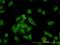 Non-SMC Condensin I Complex Subunit D2 antibody, H00009918-M01, Novus Biologicals, Immunofluorescence image 