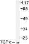 Transforming Growth Factor Alpha antibody, LS-C176240, Lifespan Biosciences, Western Blot image 