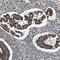 Type I inositol-1,4,5-trisphosphate 5-phosphatase antibody, PA5-52921, Invitrogen Antibodies, Immunohistochemistry frozen image 