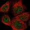 Calcium Voltage-Gated Channel Auxiliary Subunit Beta 2 antibody, PA5-57230, Invitrogen Antibodies, Immunofluorescence image 