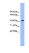 Casein Kinase 1 Alpha 1 Like antibody, NBP1-79514, Novus Biologicals, Western Blot image 