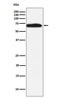 Receptor Like Tyrosine Kinase antibody, M07225-1, Boster Biological Technology, Western Blot image 