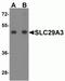 Solute Carrier Family 29 Member 3 antibody, NBP2-81829, Novus Biologicals, Western Blot image 