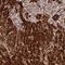 CPN10 antibody, NBP2-34055, Novus Biologicals, Immunohistochemistry paraffin image 