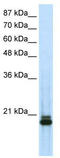Histone deacetylase complex subunit SAP18 antibody, TA343565, Origene, Western Blot image 