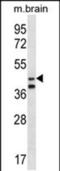 Origin Recognition Complex Subunit 5 antibody, PA5-48510, Invitrogen Antibodies, Western Blot image 