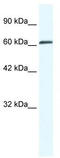 Zinc Finger MYM-Type Containing 6 antibody, TA338111, Origene, Western Blot image 