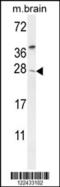 TIMP Metallopeptidase Inhibitor 4 antibody, 55-060, ProSci, Western Blot image 