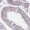 Transcription Elongation Factor A Like 8 antibody, NBP2-32425, Novus Biologicals, Immunohistochemistry paraffin image 