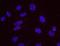 Tumor Protein P53 Binding Protein 1 antibody, NB100-1803, Novus Biologicals, Proximity Ligation Assay image 