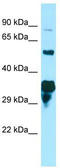 SPG21 Abhydrolase Domain Containing, Maspardin antibody, TA338044, Origene, Western Blot image 