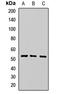 Carnosine Dipeptidase 2 antibody, LS-C668586, Lifespan Biosciences, Western Blot image 