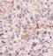 Bruton Tyrosine Kinase antibody, NBP1-78295, Novus Biologicals, Immunohistochemistry frozen image 