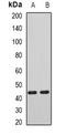 Aryl Hydrocarbon Receptor Interacting Protein Like 1 antibody, LS-C482621, Lifespan Biosciences, Western Blot image 