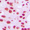 Telomerase Reverse Transcriptase antibody, LS-C368547, Lifespan Biosciences, Immunohistochemistry paraffin image 